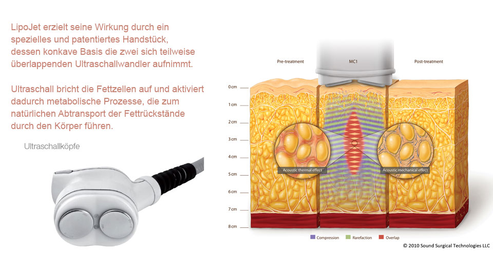 liopjet4